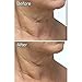 Microderm MD Skincare System with Extra 100 x Black Wool Filters