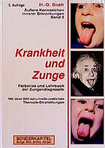 Download Antlitzdiagnostik: Äußere Kennzeichen innerer Erkrankungen, Bd.2, Krankheit und Zunge Download Antlitzdiagnostik: Äußere Kennzeichen innerer Erkrankungen, Bd.2, Krankheit und Zunge