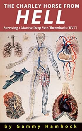 Anatomy of hell download links Anatomy of hell download links