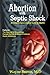 Produktbild Abortion with Septic Shock: A Complete Gynecological Guide for Women
