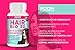 Hair Vitamins | #1 Hair Growth Products For Women | Biotin Hair Treatment Tablets | 120 Hair Vitamins Tablets | FULL 4 Month Supply | Helps Grow Hair | Achieve Thicker, Fuller Hair FAST | Safe And Effective | Best Selling Hair Growth Pills | Manufactured In The UK!