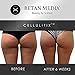 Anti Cellulite Treatment Cream & Massager: Cellulitix Cellulite Remover for Thighs & Buttocks with Adiposlim & Caffeine - Thigh & Buttock Skin Tightening, Firming Lotion for Cellulite Reduction: 100mL