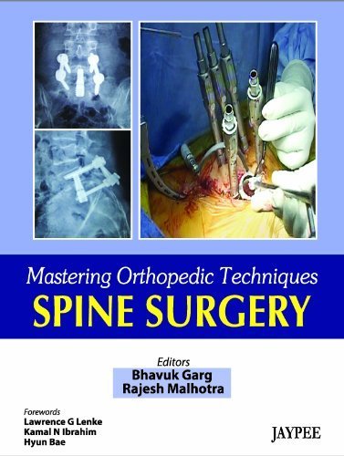 Mastering Orthopaedic Techniques Spine Surgery (Mastering Orthopedic Techniques) by Jaypee Brothers Medical Publishers (2012-05-01)