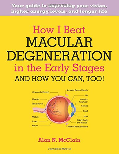 Download How I Beat Macular Degeneration in the Early Stages and How You Can, Too!: Your guide to improving your vision, higher energy levels, and longer life Download How I Beat Macular Degeneration in the Early Stages and How You Can, Too!: Your guide to improving your vision, higher energy levels, and longer life