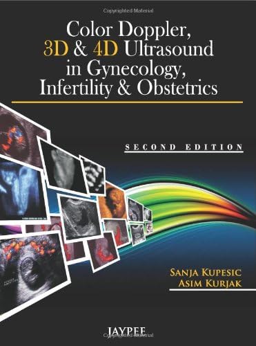 Color Doppler 3d & 4d Ultrasounds in Gynecology Infertility and Obstetrics