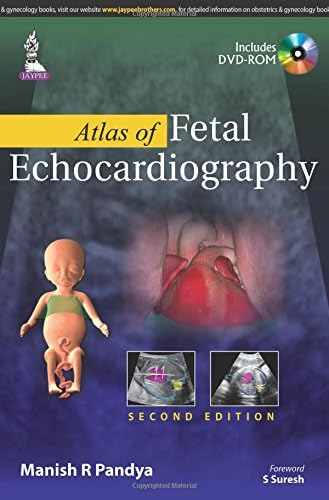 Atlas of Fetal Echocardiography with Interactive DVD-ROM