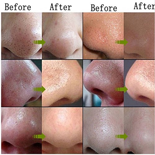 LUCKYFINE 60g Mitesser Entferner Gesichtsmaske Mud Suction Deep Clean Pore Acne Peel Purifying Black Head Peel off Maske anti Akne - 6