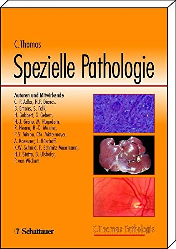 Download Allgemeine Pathologie /Spezielle Pathologie /Histopathologie. Set / Spezielle Pathologie Download Allgemeine Pathologie /Spezielle Pathologie /Histopathologie. Set / Spezielle Pathologie
