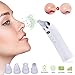 Produktbild Mitesserentferner Mitesser Sauger Porenreiniger Mitesser Entferner Pickel Entfernen Porenreiniger Poren Reinigung Vakuum Peeling Akne Mitesserentferner Set 5 Niveaus Absaugung USB Aufladung mit LED Anzeige und 4 Austauschbaren Reinigungsaufsätzen (Weiß)