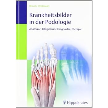 Pdf Krankheitsbilder In Der Podologie Anatomie Bildgebende Diagnostik Therapie Kostenlos Download Lesen Sie Das Vollstandigste Online Buch 14lesen Sie Das Vollstandigste Online Buch 14