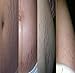 Malloom 2017 New Remove Stretch Marks Repair Cream 100g Postpartum Repair to Eliminate Obesity Pattern