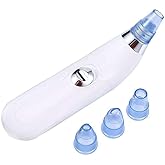 Eloxee 4-in-1 Blackhead Remover Vacuum – Electric Pore Cleaner with Adjustable Suction & Interchangeable Heads - Facial Device for Men & Women (Blue) 