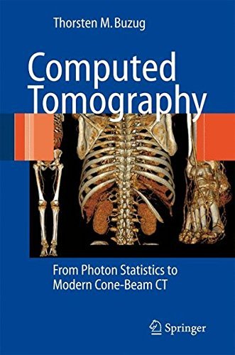 Computed Tomography: From Photon Statistics to Modern Cone-Beam CT by Thorsten M. Buzug (2010-11-06)