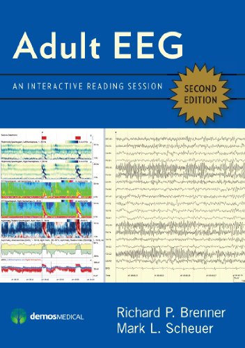 Preisvergleich Produktbild Adult Eeg, Second Edition: An Interactive Reading Session