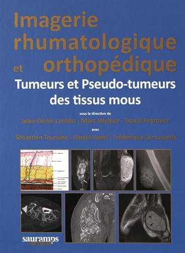 Imagerie rhumatologique et orthopédique : Tome 5, Tumeurs et pseudo-tumeurs des tissus mous gratuit