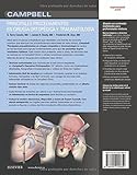 Image de Campbell. Principales Procedimientos En Cirugía Ortopédica Y Traumatología + Expertconsult