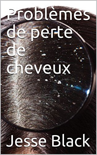 Download Problèmes de perte de cheveux Download Problèmes de perte de cheveux