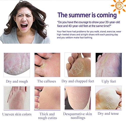 Fuß Peeling Maske,Hornhautsocke,Foot Exfoliation Mask,LDream® Peeling Füße Fuß Maske Perfectly Peeling Away Hornschwiele und Tote Haut Zellen Auch Leckerli unangenehme geruch Peeling, hart und tote Haut,Schwielen Peeling-Maske für die Füße,2 Pack (2 x 2 Stück) - 2