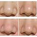 Jspoir Melodiz 3 Mask Remove Blackhead Acne Remover Clear Black Head Nose Step Kit Beauty Clean Cosmetic Accessory women gift cosmetic tools