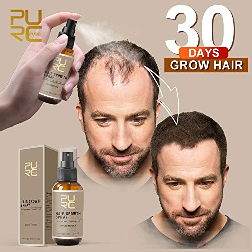 PURC 2019 New Hair Growth Spray Fast Grow Hair Hair LossTreatment Preventing Hair Loss Hair Care 30ml prevent hair loss vitalite