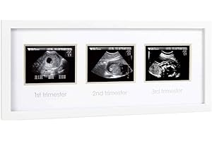Pearhead Pregnancy Trimester Sonogram Frame, Ultrasound Picture Frame, Pregnancy Milestone Keepsake Photo Frame, Sonogram Keepsake, Gender-Neutral Baby Nursery Décor, 1st 2nd and 3rd Trimester, White