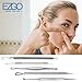 EZGO Blackhead & Blemish Remover Kit/Tool, 5 Professional Surgical Extractor Instruments, Cure Pimples, Blackheads, Comedones, Acne (Blue)