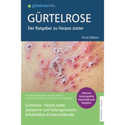 Gürtelrose Ratgeber Gürtelrose Ratgeber