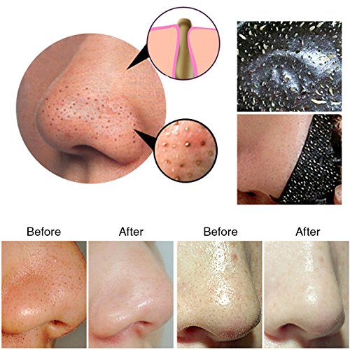Blackhead Peel Off Maske, LuckyFine Baby Skin Reinigungsmaske Mitesser Akne Öl-Kontrolle 70g - 7