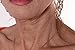 Nexsey Sagging Wrinkly Wrinkles Neck Skin Double Chin Lifting Tightening Smoothing Lift Tape