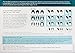HairMax LaserComb Professional 12