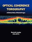 Image de Optical Coherence Tomography a Clinical Atlas of Retinal Images