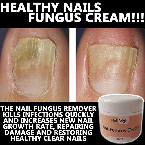 NAIL BRIGHT NUMBER ONE NAIL FUNGUS REMOVER !! FAST & EFFECTIVE !!!!