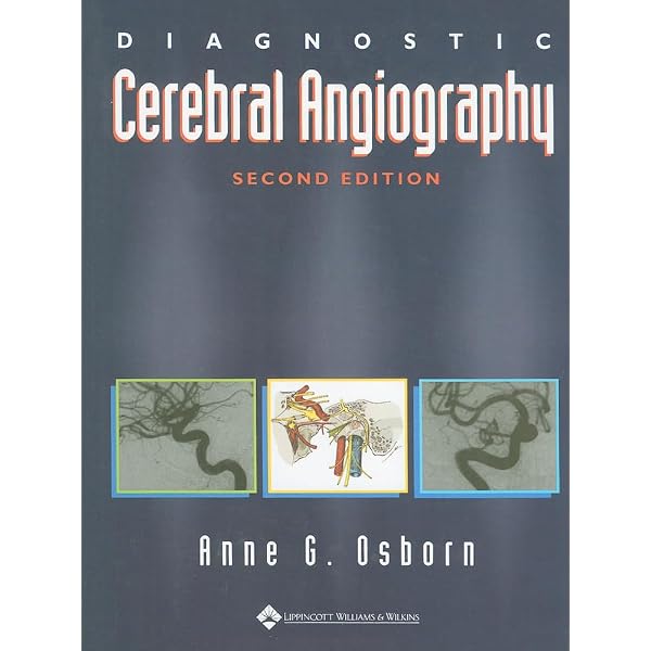 Buy Decision Making in Neurovascular Disease Book Online at Low