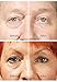 RX Flawless Eyes