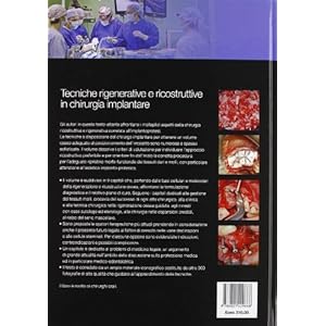 Tecniche rigenerative e ricostruttive in chirurgia implantare