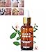 DANCINGNAIL 30ML Fungal Treatment Essence Toe Removal Nail Feet Care Serum Foot Whitening