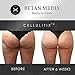 Anti Cellulite Treatment Cream & Massager: Cellulitix Cellulite Remover for Thighs & Buttocks with Adiposlim & Caffeine - Thigh & Buttock Skin Tightening, Firming Lotion for Cellulite Reduction: 100mL