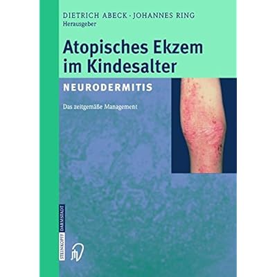 [PDF] Atopisches Ekzem im Kindesalter (Neurodermitis): Zeitgemáßes Management KOSTENLOS DOWNLOAD