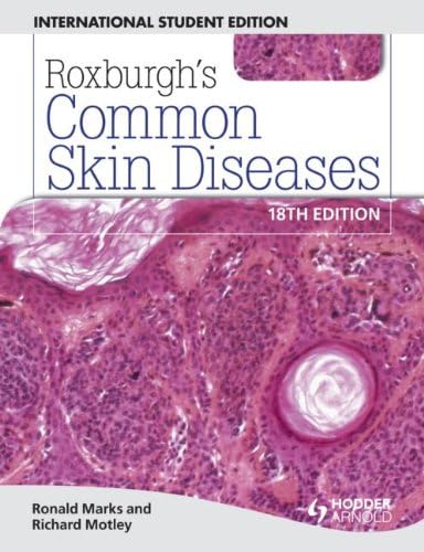 ROXBURGH'S COMMON SKIN DISEASES(IE)