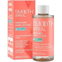 Smooth Appeal Ingrown Hair Lotion - The Ultimate Solution for ...