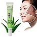 LuckyFine Acne Remove Anti-acne Scar Blemish Face Skin Care Treatment Aloe Vera Gel