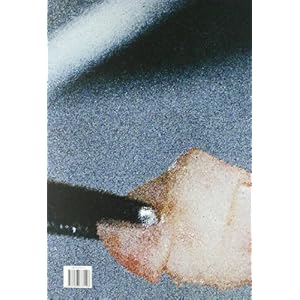 Cirugía Mucogingival