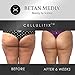 Anti Cellulite Treatment Cream & Massager: Cellulitix Cellulite Remover for Thighs & Buttocks with Adiposlim & Caffeine - Thigh & Buttock Skin Tightening, Firming Lotion for Cellulite Reduction: 100mL