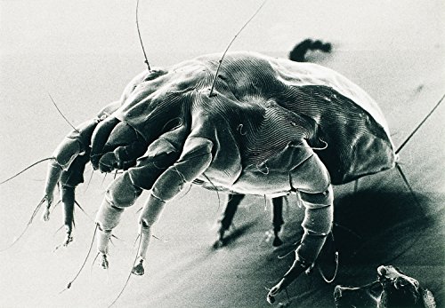 Ultraschall Milbencontroller gegen Milben Hausstaubmilben Allergie - 3