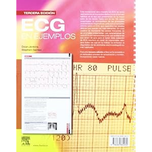 ECG en ejemplos