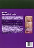 Image de Manuale di dermatologia medica