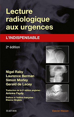Download Lecture radiologique aux urgences : l'indispensable Download Lecture radiologique aux urgences : l'indispensable