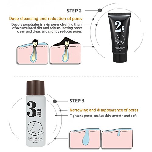 Gesichtsmask, LuckyFine 3 Steps Kits Blackhead Akne Mitesser entfernen Aktivkohle Maske Gesichtsmask - 3