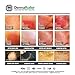Koi Beauty derma roller 192 needles 0.5-2.0mm tip depth stretch marks hair loss face eye ance (0.5mm)