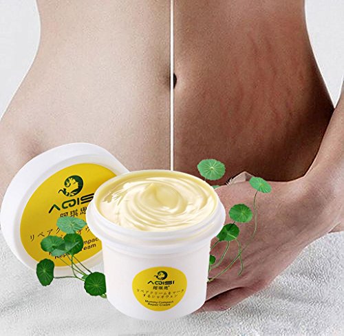Malloom 2017 New Remove Stretch Marks Repair Cream 100g Postpartum Repair to Eliminate Obesity Pattern